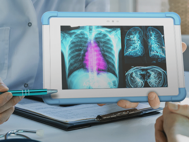 Tablet showing lung imaging